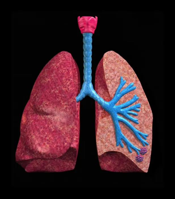 Framed Print : Human Lungs Print Framed Print : Human Lungs Print