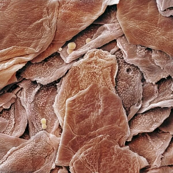 Human Skin Cells (SEM)