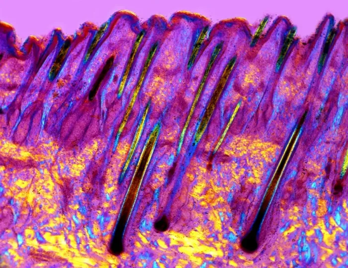 Framed Print : Human Skin Print, Polarised Light Micrograph Framed Print : Human Skin Print, Polarised Light Micrograph