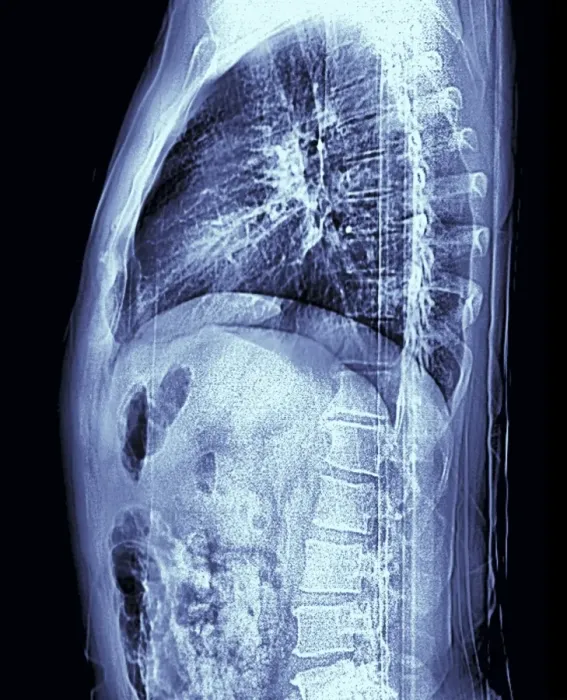 Framed Print : Normal Human Torso MRI Scan Print Framed Print : Normal Human Torso MRI Scan Print