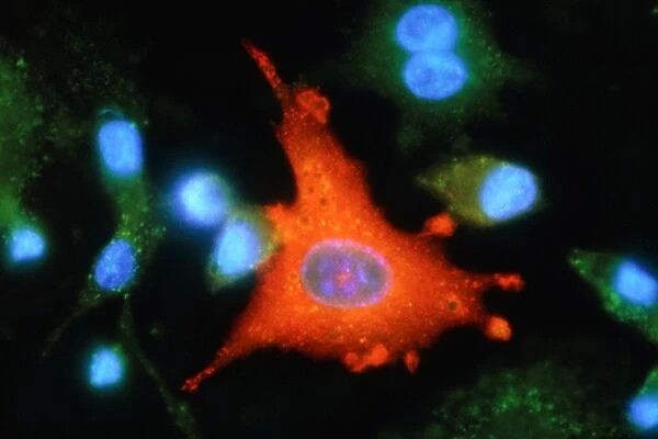 Immunofluorescent LM of an active macrophage