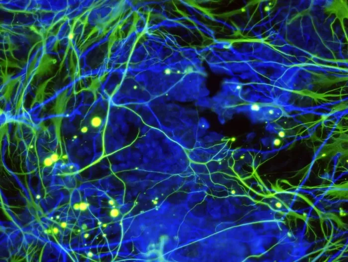 Framed Print : Induced Nerve Stem Cells Print Framed Print : Induced Nerve Stem Cells Print