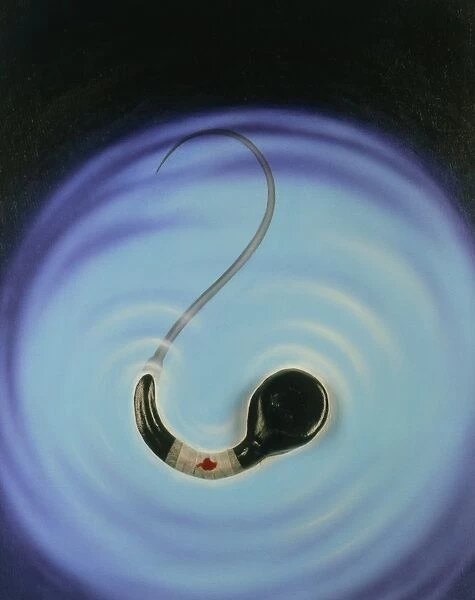 Infertility: Artwork of a sperm with bandage