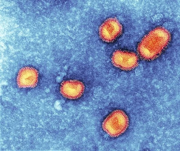 Influenzavirus B, TEM