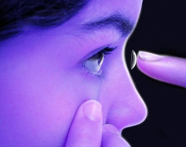Inserting contact lens