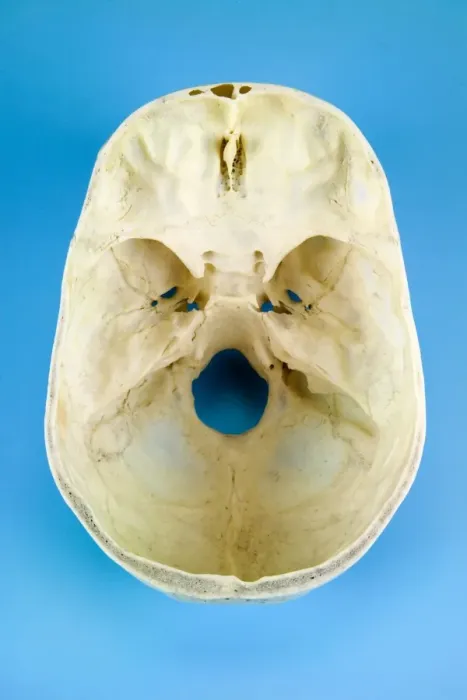 Framed Print : Top View of a Sectioned Human Skull Print Framed Print : Top View of a Sectioned Human Skull Print