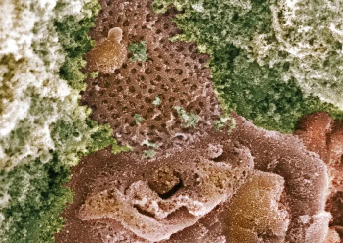 Framed Print : Kidney glomerulus surface, SEM Print Framed Print : Kidney glomerulus surface, SEM Print