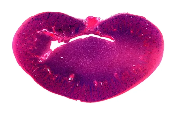 Framed Print : Kidney, longitudinal section Print Framed Print : Kidney, longitudinal section Print