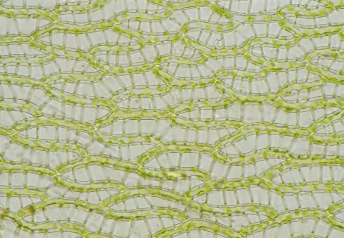 Framed Print : Sphagnum Moss Leaf Micrograph Print Framed Print : Sphagnum Moss Leaf Micrograph Print