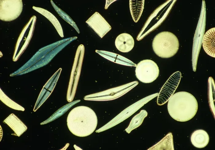 Framed Print : Light Micrograph Print of Diatoms Framed Print : Light Micrograph Print of Diatoms