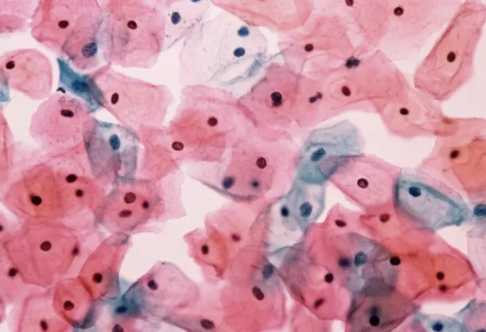 Framed Print : Light Micrograph Print of Normal Cervical Cells Framed Print : Light Micrograph Print of Normal Cervical Cells