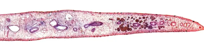 Framed Print : Liver fluke, transverse section Print Framed Print : Liver fluke, transverse section Print