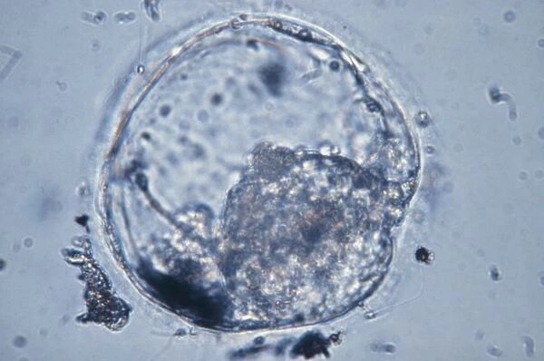 LM of human blastocyst, 4-5 days post-fertilisatn
