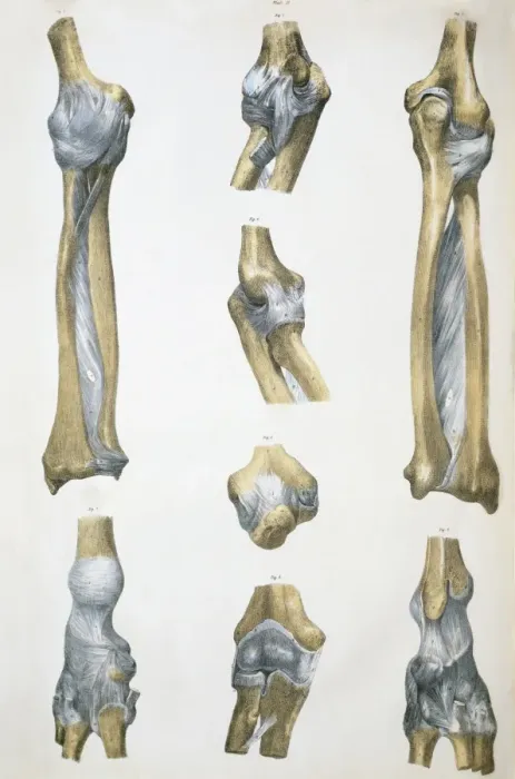 Framed Print : Lower Arm Bones and Ligaments Print Framed Print : Lower Arm Bones and Ligaments Print