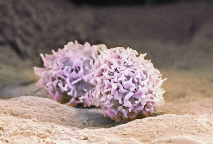 Framed Print : SEM Print of Macrophage Cells Framed Print : SEM Print of Macrophage Cells
