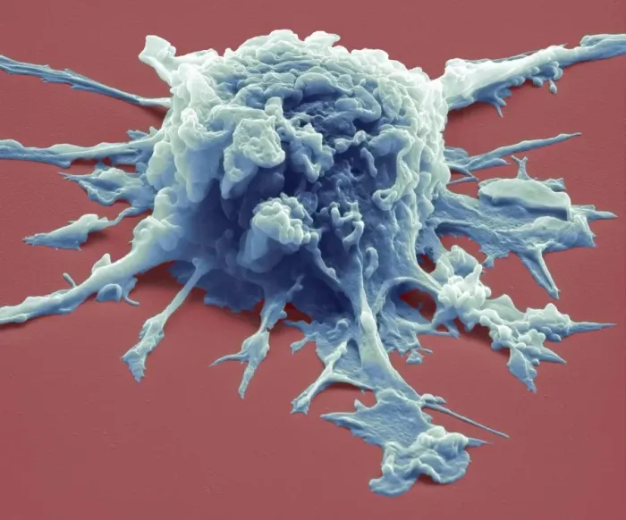 Framed Print : Macrophage Print, SEM Image Framed Print : Macrophage Print, SEM Image