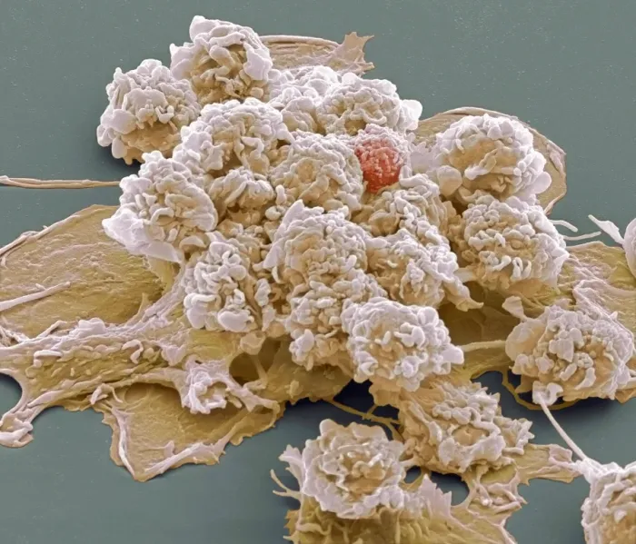 Framed Print : SEM Print of a Macrophage Cell Framed Print : SEM Print of a Macrophage Cell