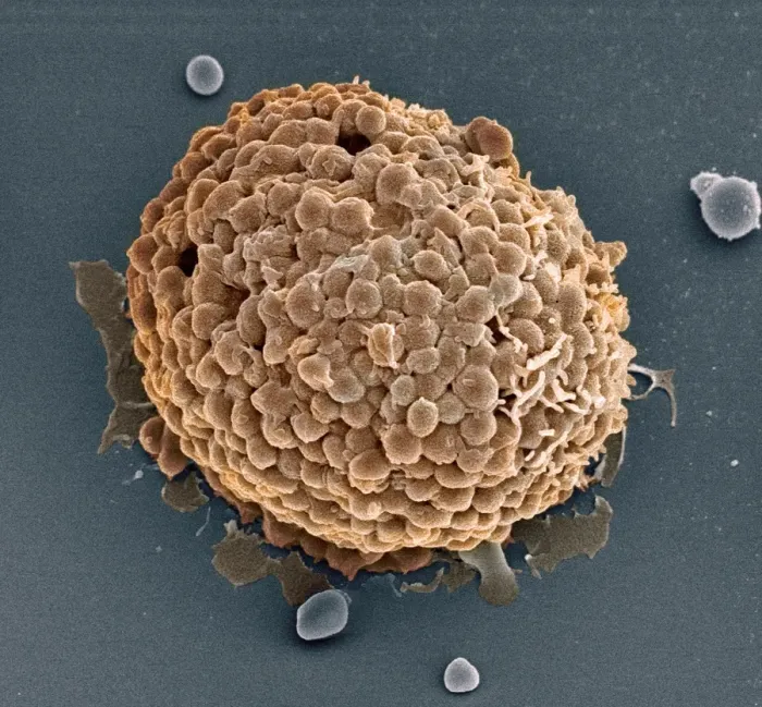 Framed Print : Mast Cell Print, SEM Image