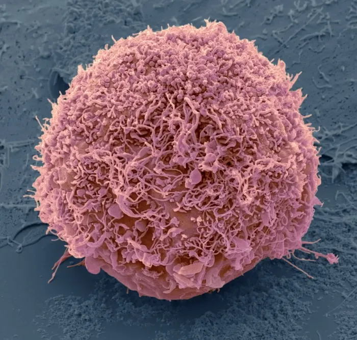 Framed Print : Mesenchymal stem cell Print, SEM image of a single human MSC Framed Print : Mesenchymal stem cell Print, SEM image of a single human MSC