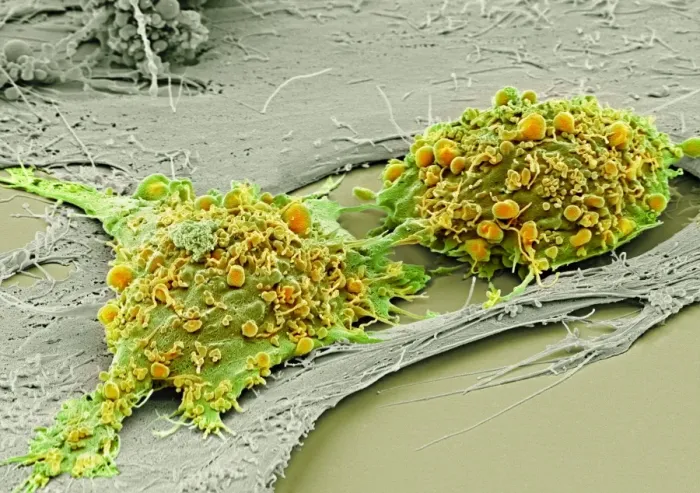 Framed Print : Print of Mesenchymal stem cells in SEM Framed Print : Print of Mesenchymal stem cells in SEM
