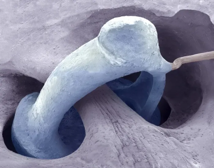 Framed Print : Coloured SEM Print of Middle Ear Bones Framed Print : Coloured SEM Print of Middle Ear Bones