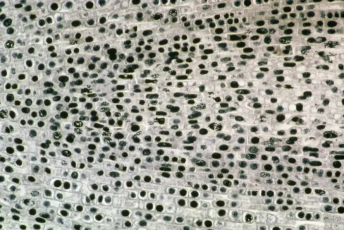 Framed Print : Mitosis in Broad Bean Root Tip Print, Light Micrograph Framed Print : Mitosis in Broad Bean Root Tip Print, Light Micrograph