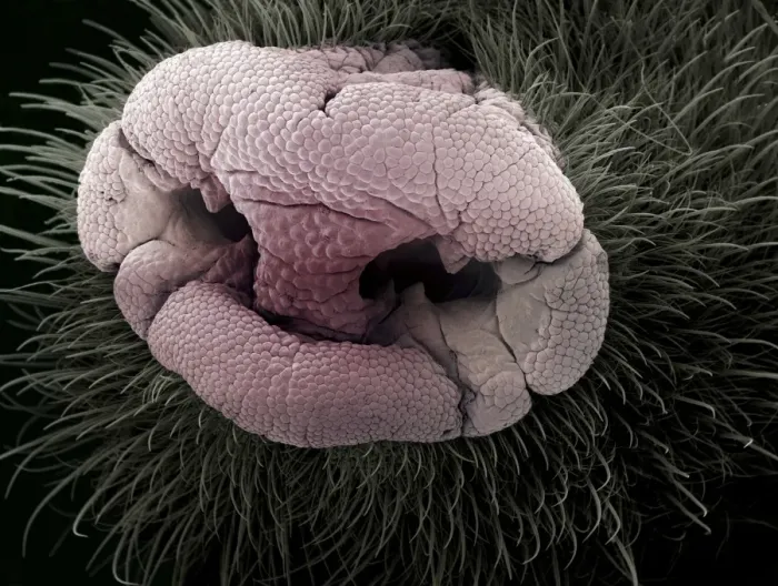 Framed Print : Coloured SEM Print of a Mole's Snout Framed Print : Coloured SEM Print of a Mole's Snout