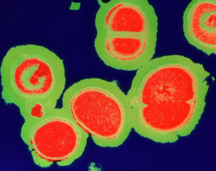 Framed Print : MRSA Bacteria Cluster Print Framed Print : MRSA Bacteria Cluster Print