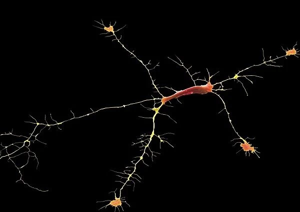 Nerve cell, SEM