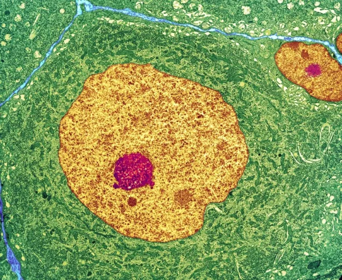 Framed Print : Nerve Cell Print - Coloured TEM Image Framed Print : Nerve Cell Print - Coloured TEM Image