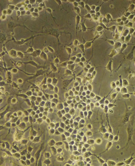 Framed Print : Neural Stem Cells Print - Light Micrograph of Mouse Embryo Tissue Framed Print : Neural Stem Cells Print - Light Micrograph of Mouse Embryo Tissue