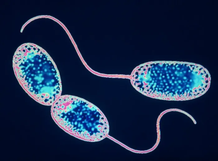 Framed Print : Nitrobacter sp bacteria Print, TEM image Framed Print : Nitrobacter sp bacteria Print, TEM image