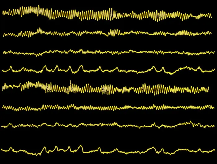 Framed Print : Normal EEG print of alpha brain waves in black and white Framed Print : Normal EEG print of alpha brain waves in black and white