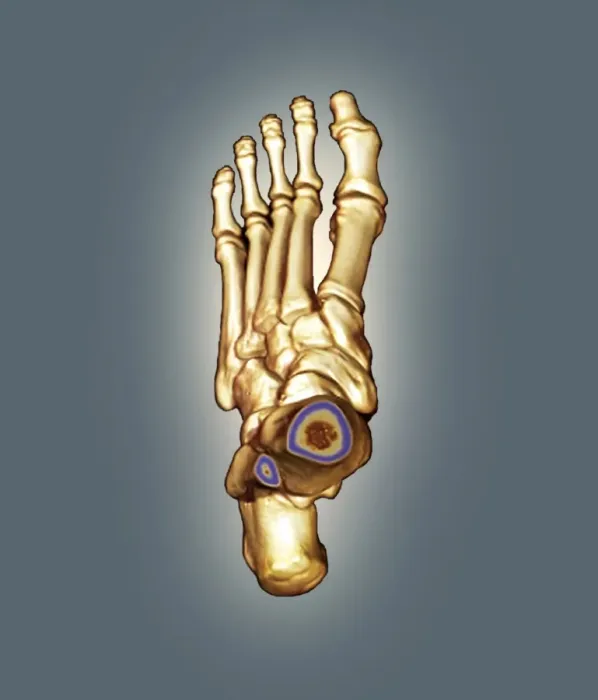 Framed Print : Normal Foot 3D CT Scan Print Framed Print : Normal Foot 3D CT Scan Print