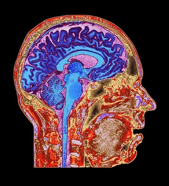 Normal human brain, MRI scan C016  /  8845