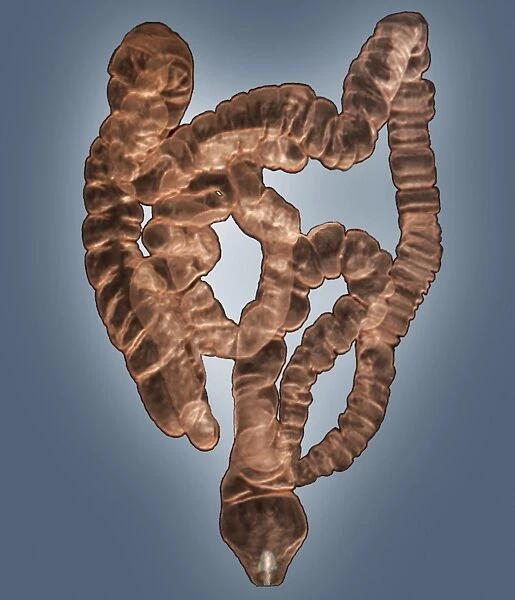 Normal intestines, 3D CT scan