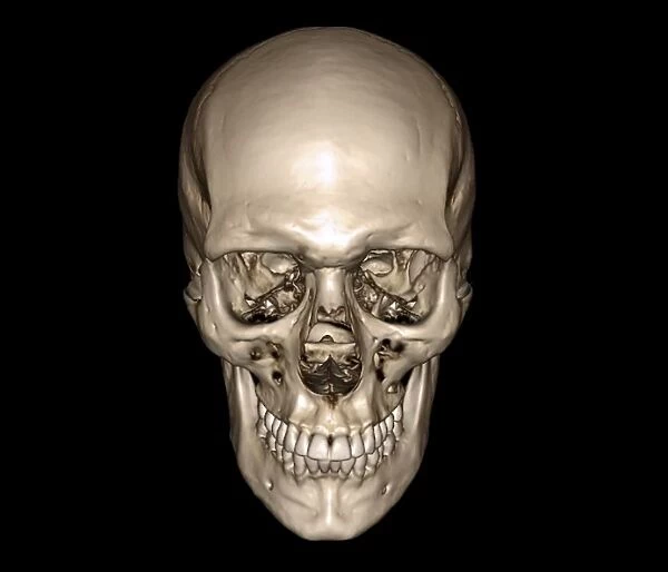 Normal skull, 3D CT scan C016  /  6326