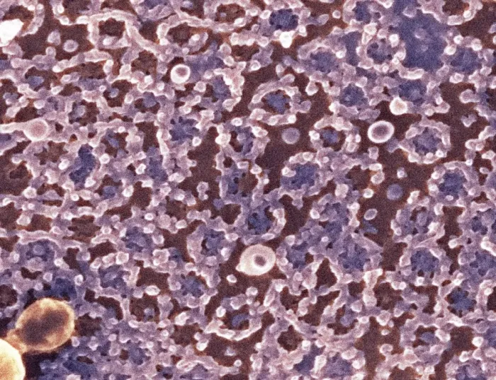 Framed Print : Nuclear Pore Complexes Print, SEM Framed Print : Nuclear Pore Complexes Print, SEM