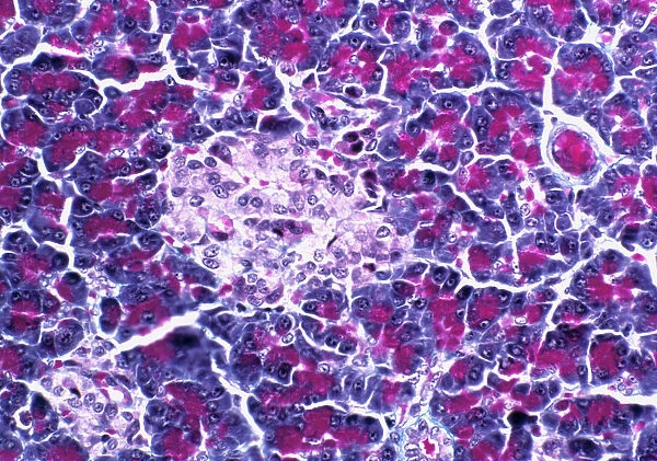 Pancreatic islet of Langerhans