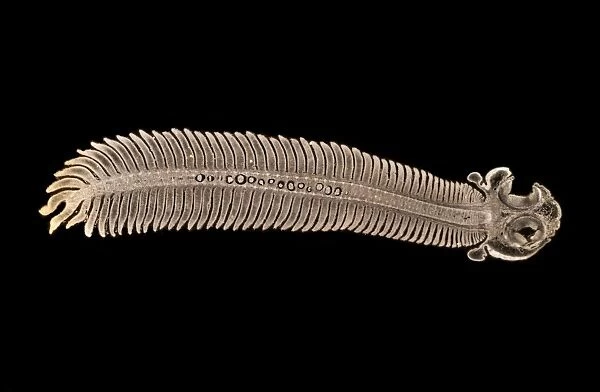 Paraneplocephala tapeworm, micrograph C014  /  4860