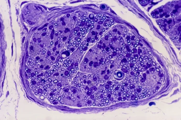Framed Print : Peripheral nerve print, x200 magnification Framed Print : Peripheral nerve print, x200 magnification