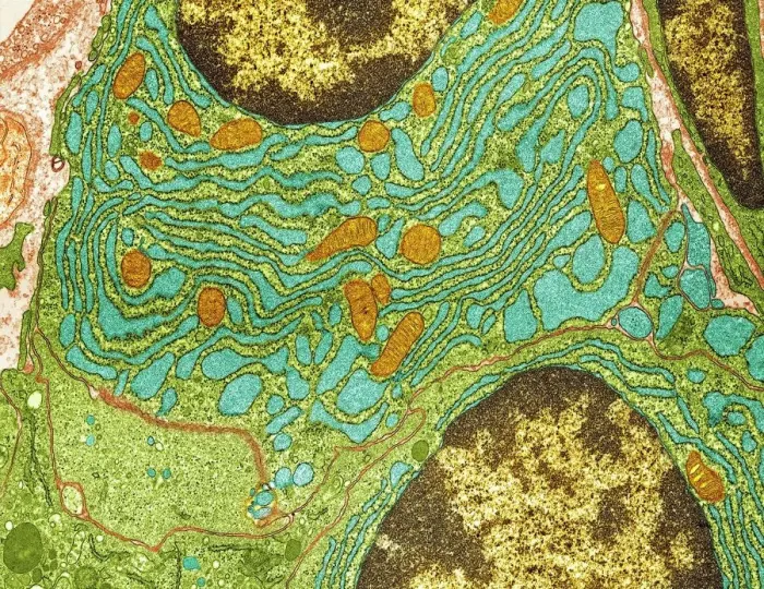 Framed Print : Plasma Cell TEM Print Framed Print : Plasma Cell TEM Print