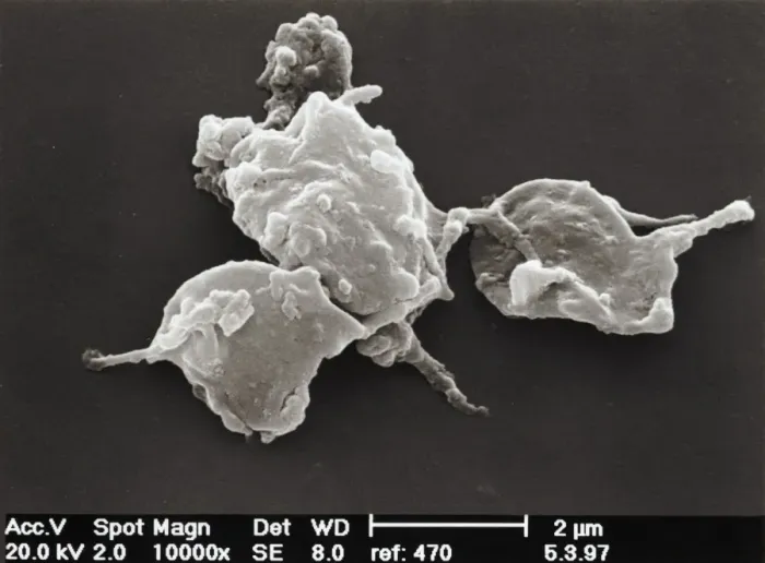 Framed Print : SEM Platelet Print, 7x9.5 inch, x25,000 magnification Framed Print : SEM Platelet Print, 7x9.5 inch, x25,000 magnification