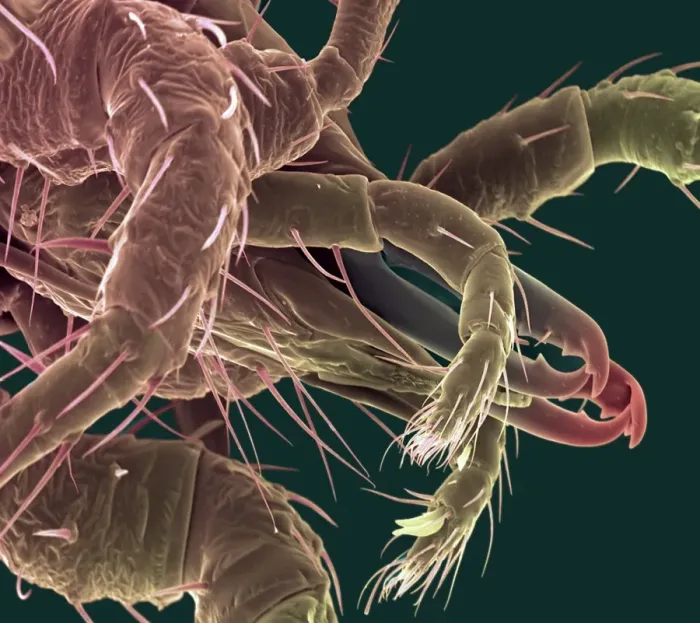 Framed Print : Predatory mite Print: Phytoseiulus sp. SEM image, x200 magnification Framed Print : Predatory mite Print: Phytoseiulus sp. SEM image, x200 magnification