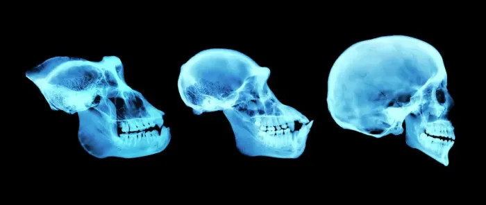 Framed Print : Coloured X-ray Print of Primate Skulls