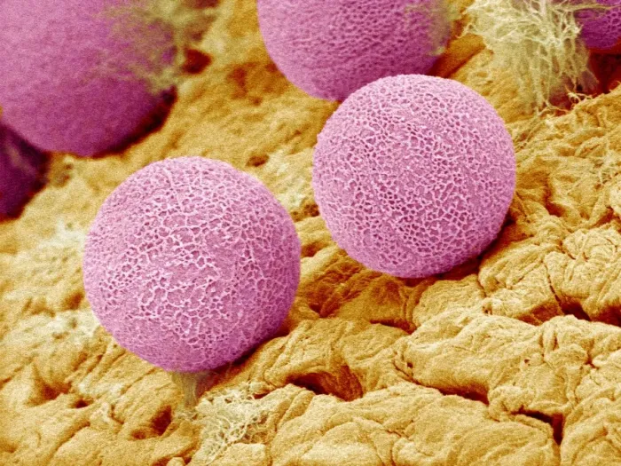 Framed Print : Primrose pollen print, SEM Framed Print : Primrose pollen print, SEM