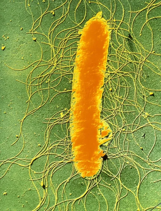 Framed Print : Proteus mirabilis False-colour Transmission Electron Micrograph Print Framed Print : Proteus mirabilis False-colour Transmission Electron Micrograph Print