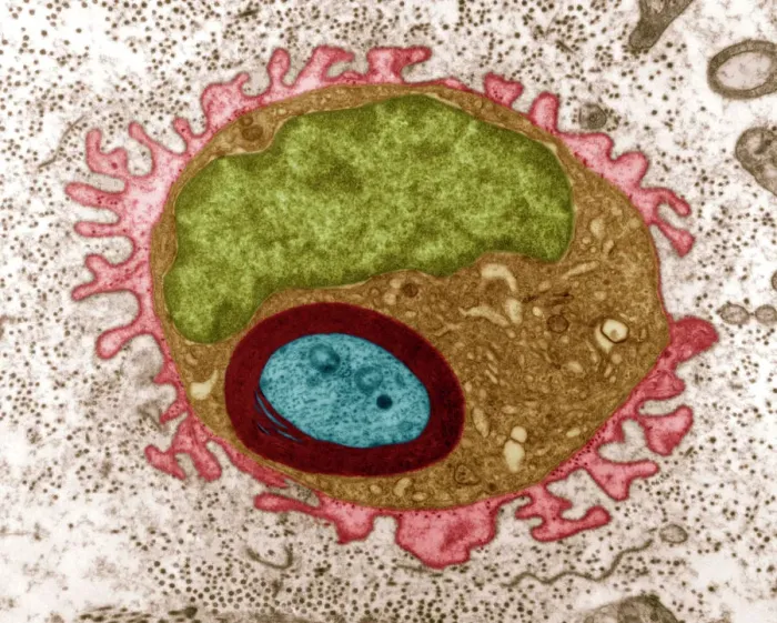 Framed Print : Regenerating nerve cell Print, TEM image