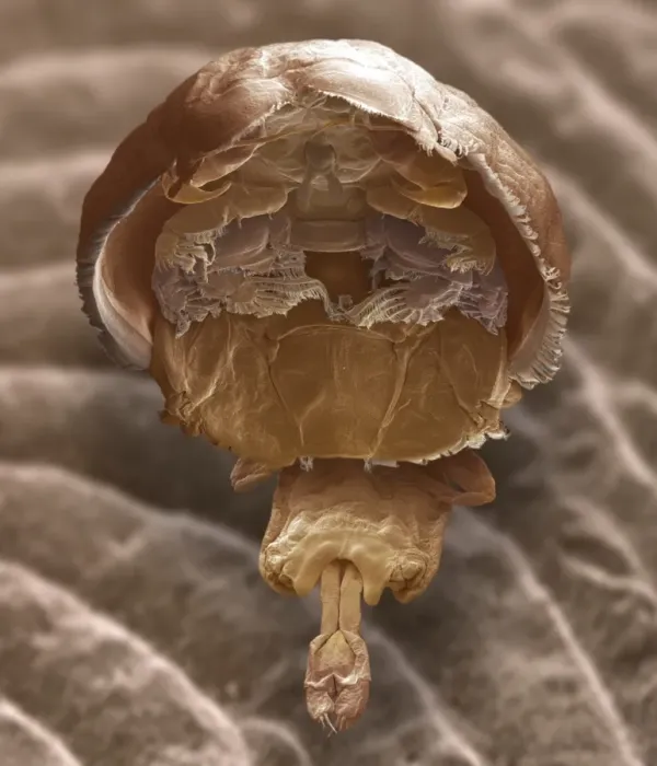 Framed Print : Print of Salmon Louse, SEM Framed Print : Print of Salmon Louse, SEM
