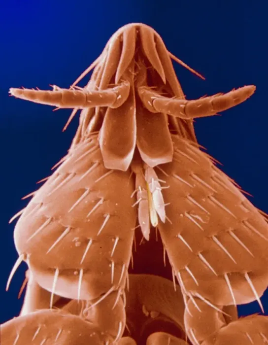 Framed Print : Scanning Electron Micrograph Print of a Cat Flea Head Framed Print : Scanning Electron Micrograph Print of a Cat Flea Head